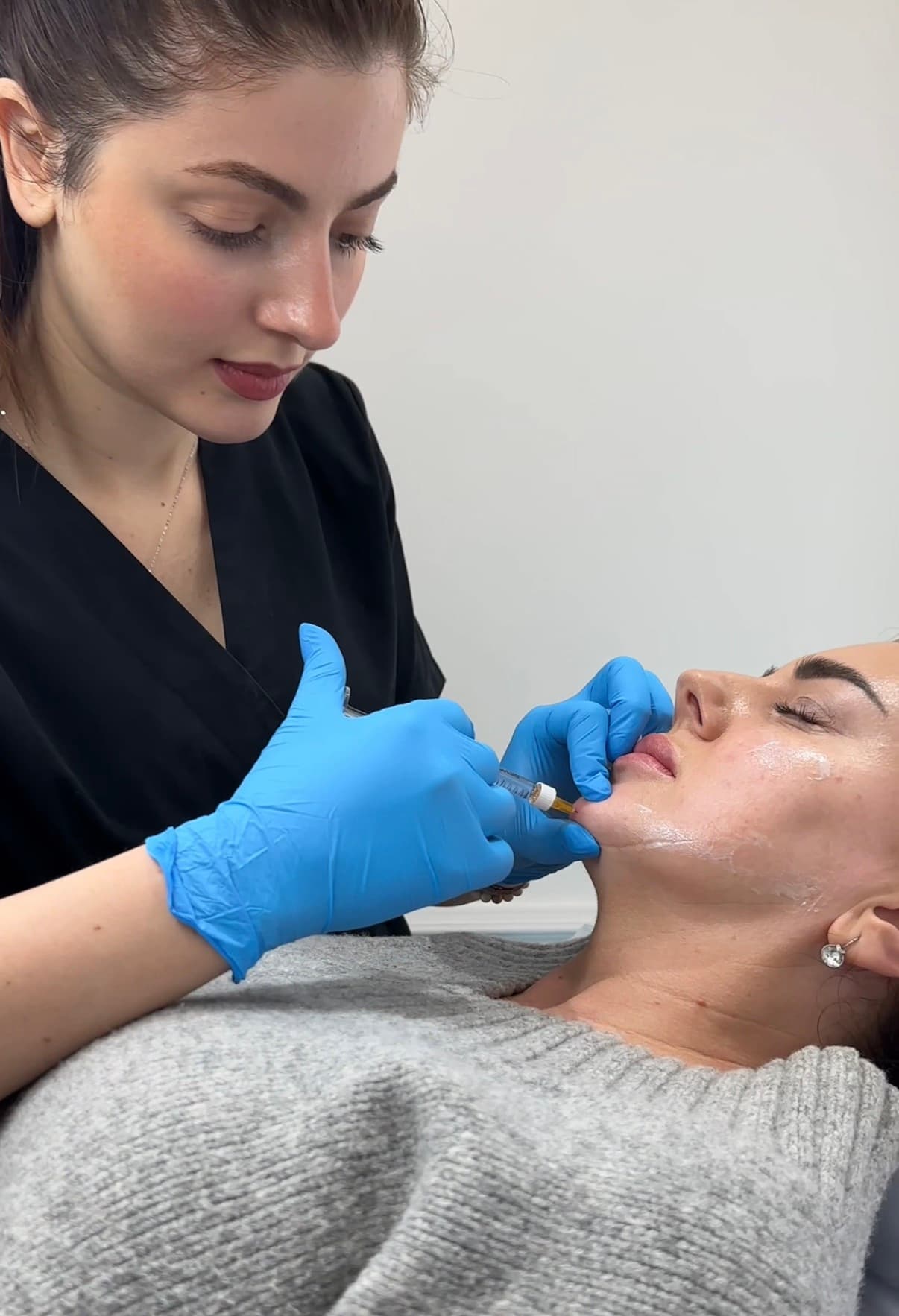 Dermal fillers London Mayfair — doctor-led aesthetic treatment at Dr Alexa