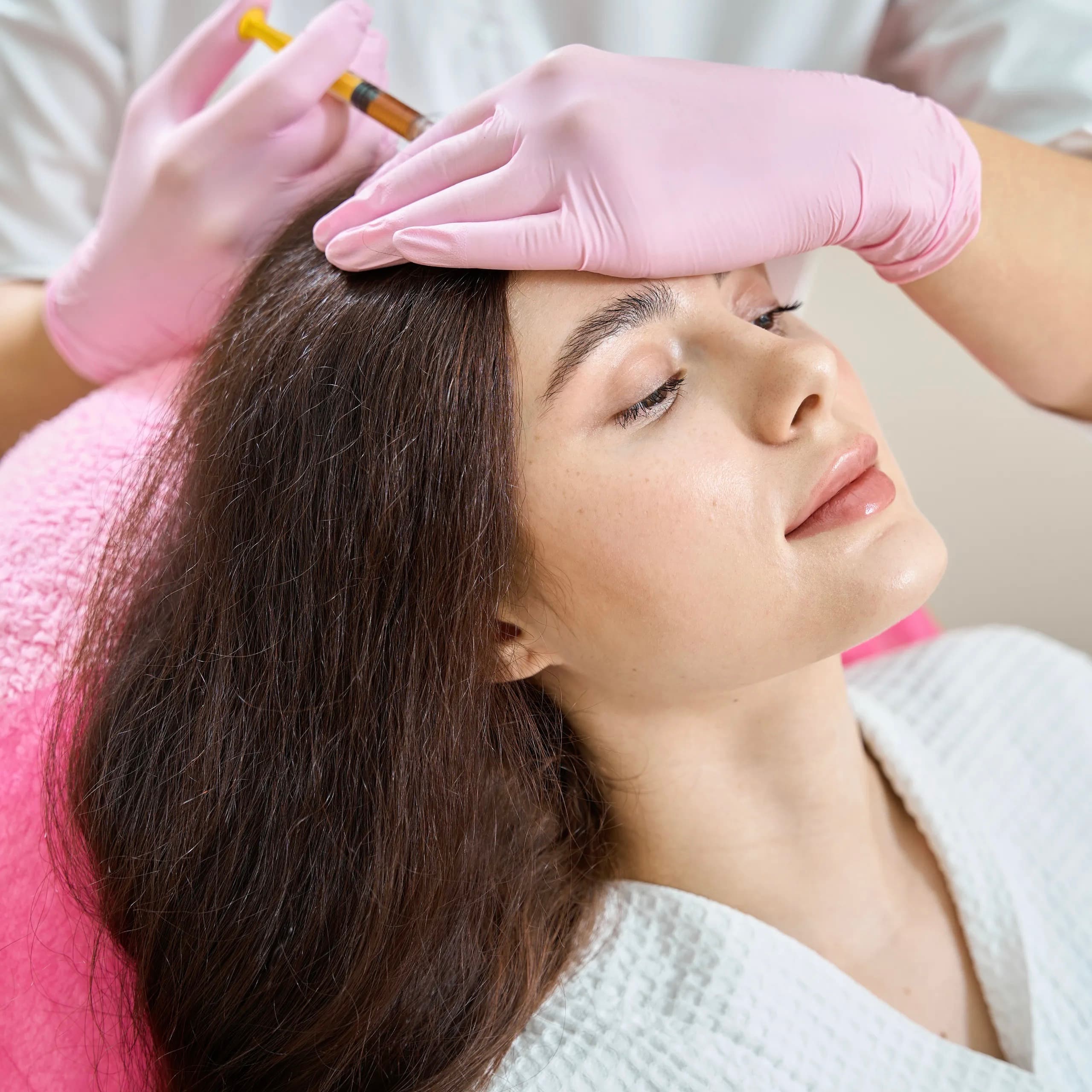 PRP / PRF for Acne Scarring at Dr Alexa, London